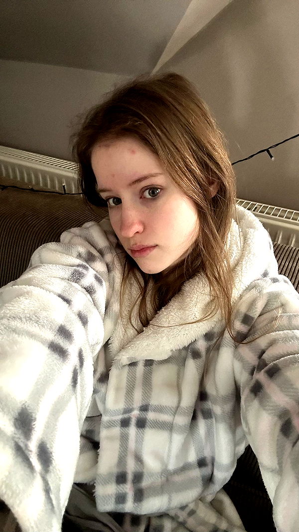 mira.0004 image ~ Altpins