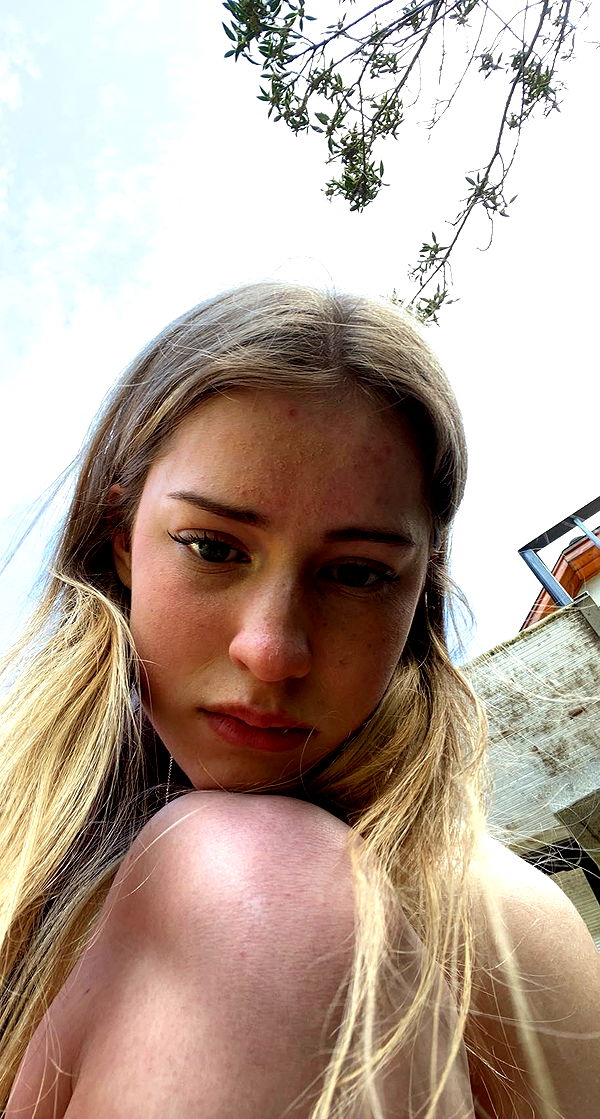 mira.0004 image ~ Altpins