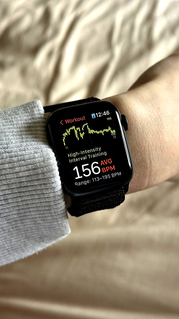 mira.0004 image ~ Altpins