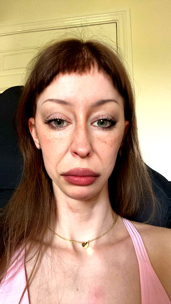 mira.0004 image ~ Altpins