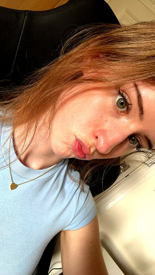 mira.0004 image ~ Altpins