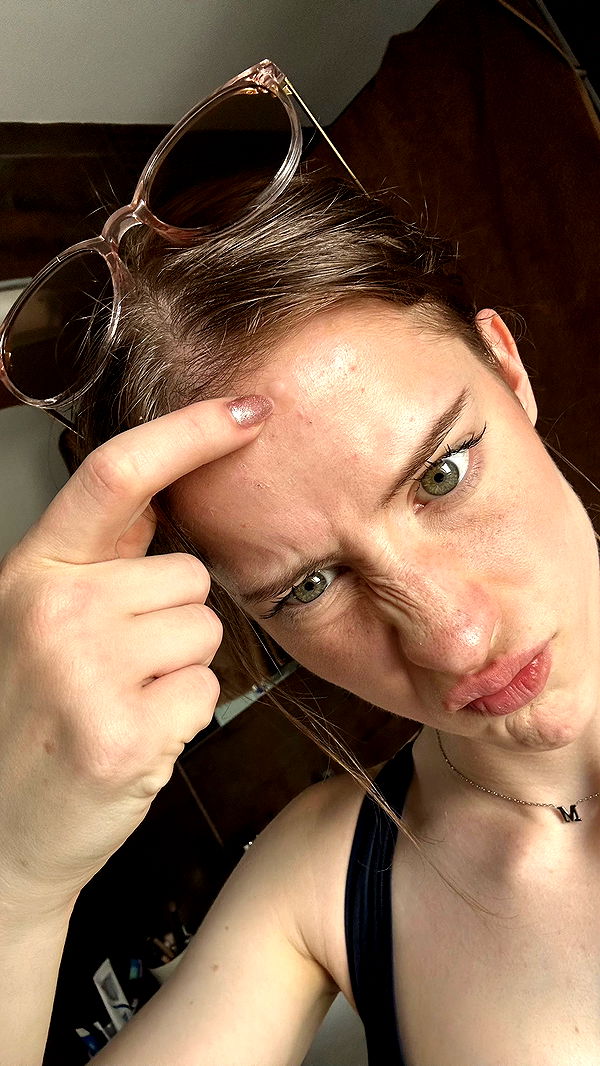 mira.0004 image ~ Altpins