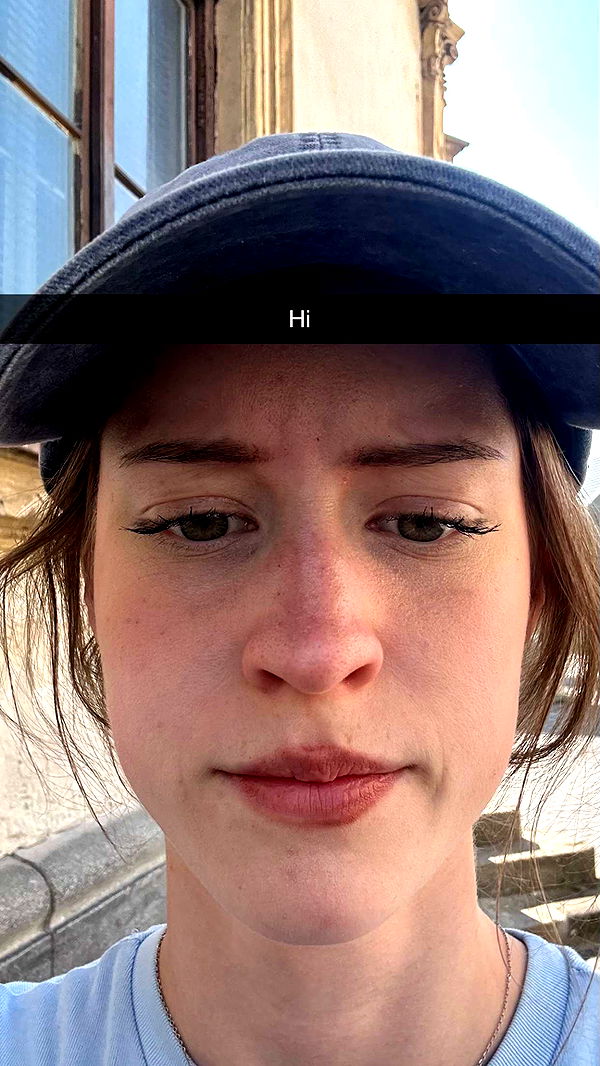 mira.0004 image ~ Altpins