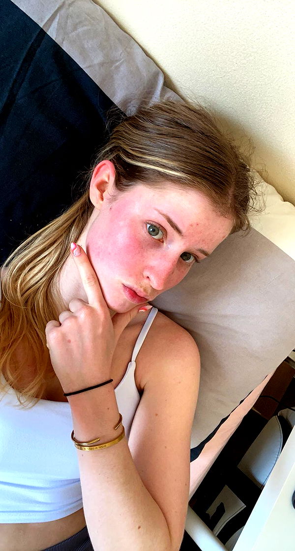 mira.0004 image ~ Altpins