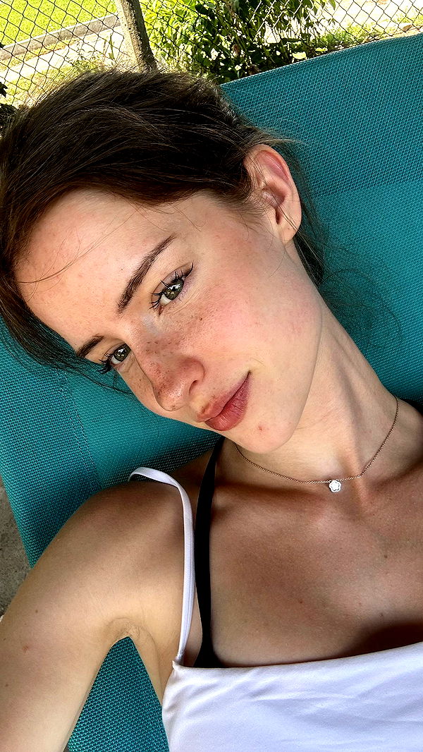 mira.0004 image ~ Altpins