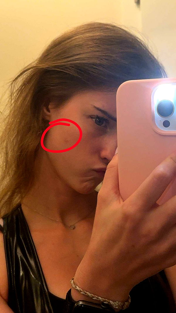 mira.0004 image ~ Altpins