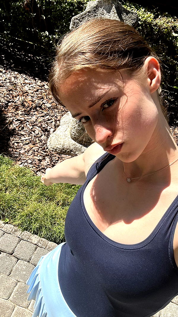 mira.0004 image ~ Altpins