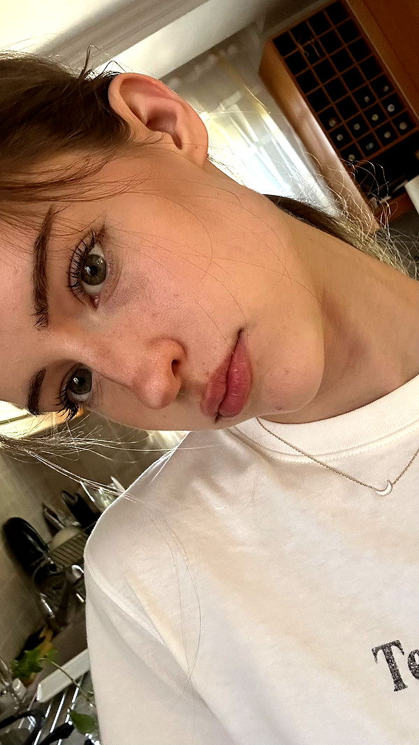 mira.0004 image ~ Altpins