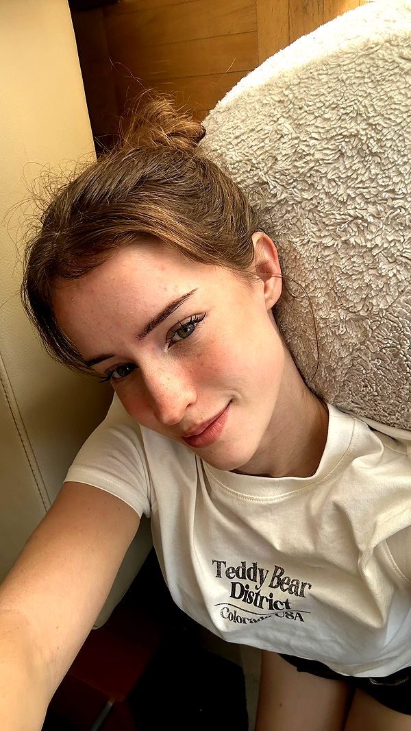 mira.0004 image ~ Altpins