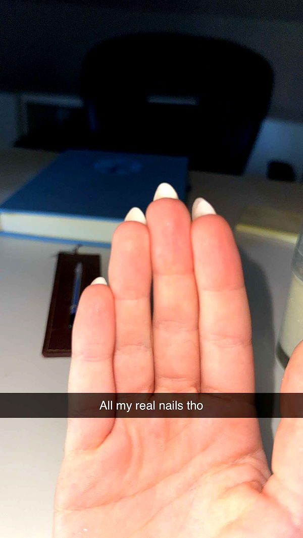 mira.0004 image ~ Altpins