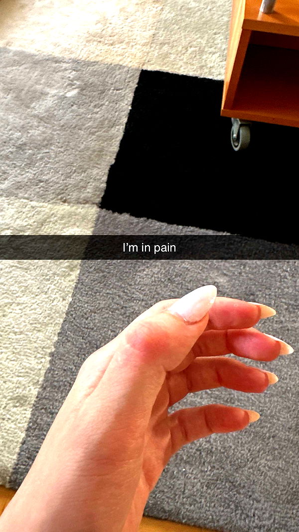 mira.0004 image ~ Altpins