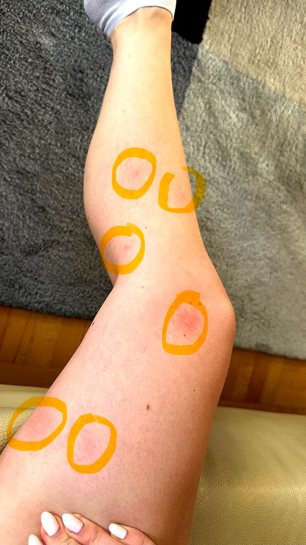 mira.0004 image ~ Altpins