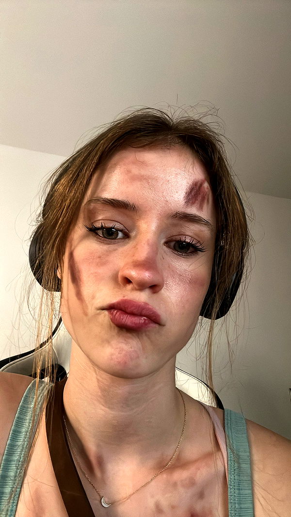 mira.0004 image ~ Altpins