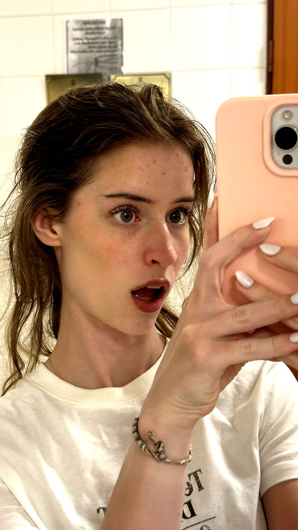 mira.0004 image ~ Altpins