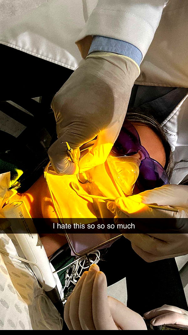 ppwyang0 image ~ Altpins