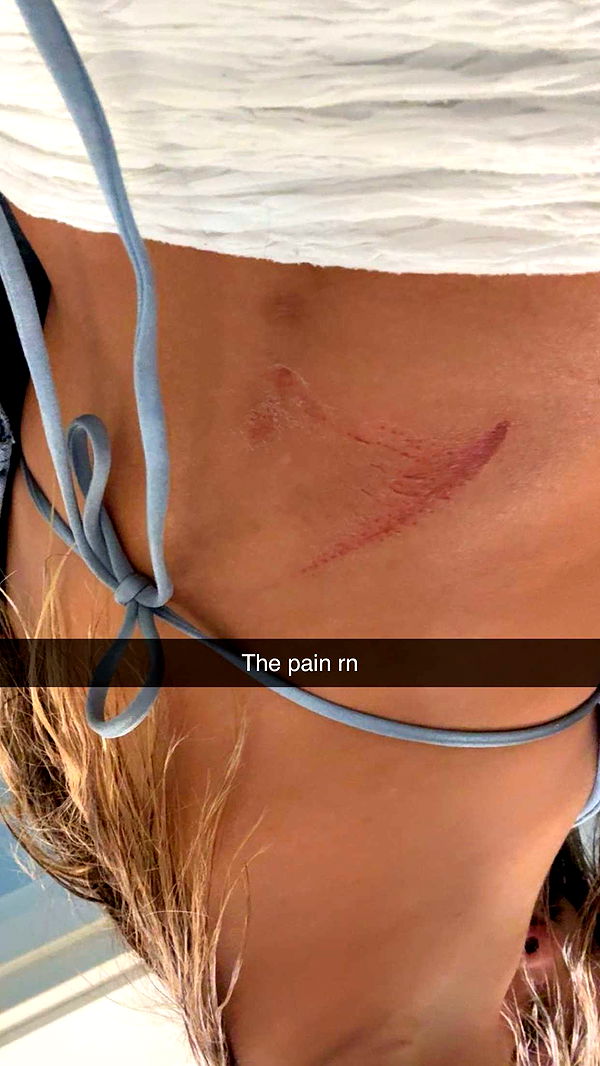 ppwyang0 image ~ Altpins