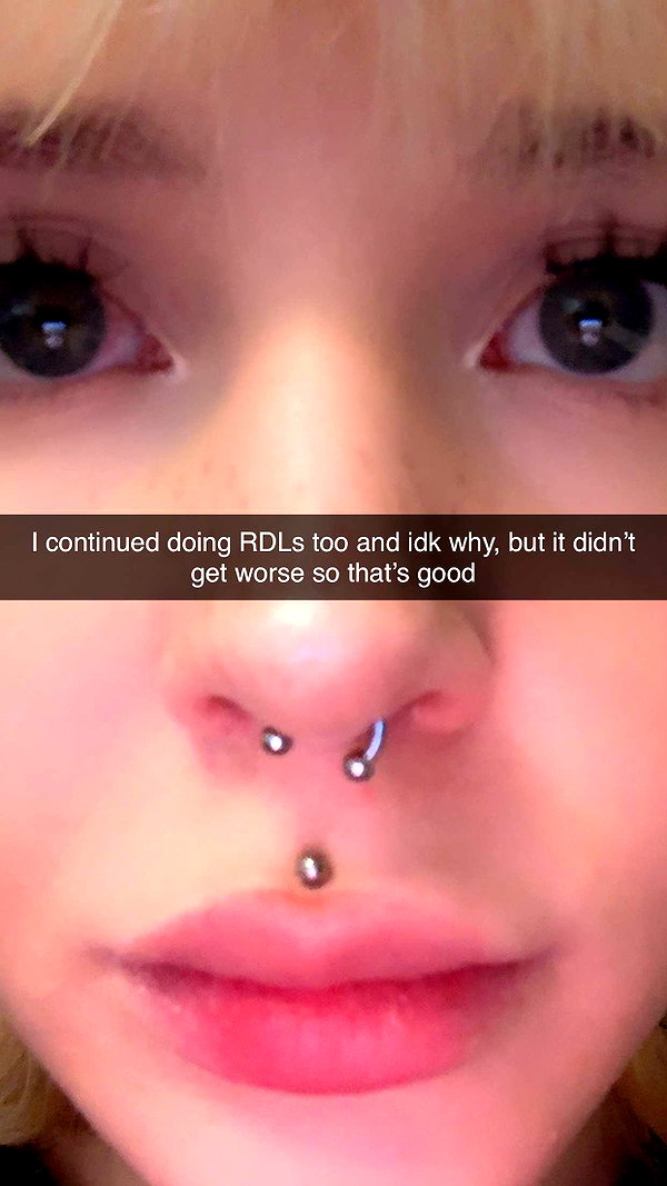 ratskelet0n snapchat image archive image