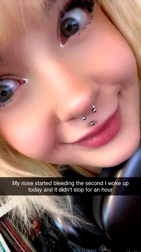 ratskelet0n snapchat image archive image