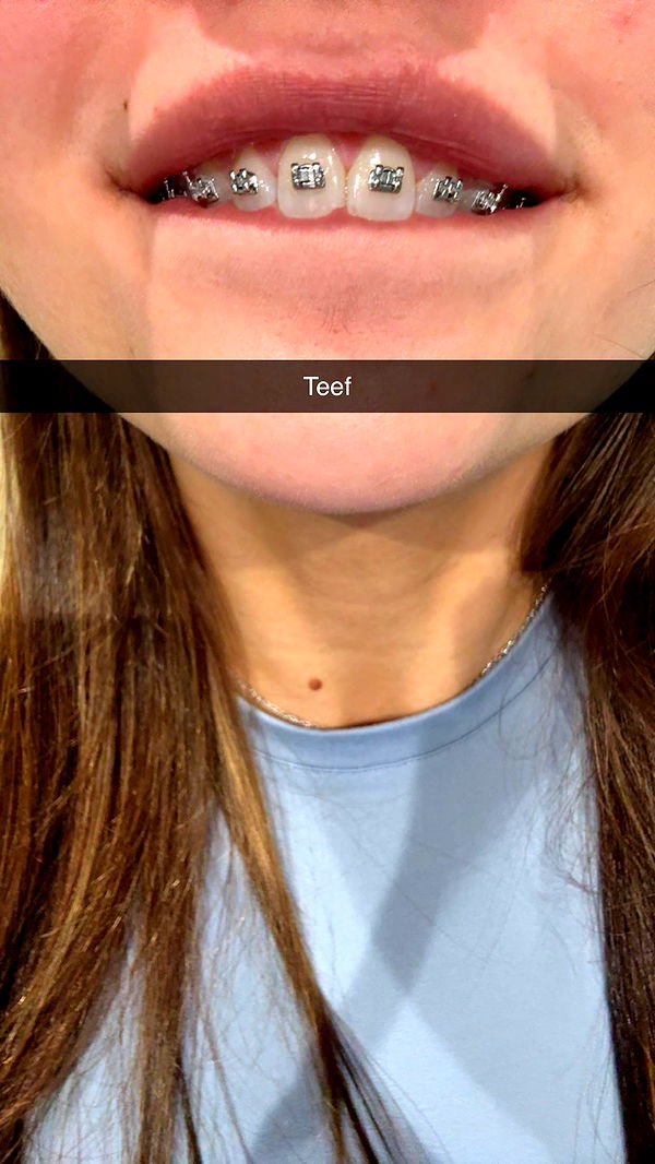 realhaylujan image ~ Altpins