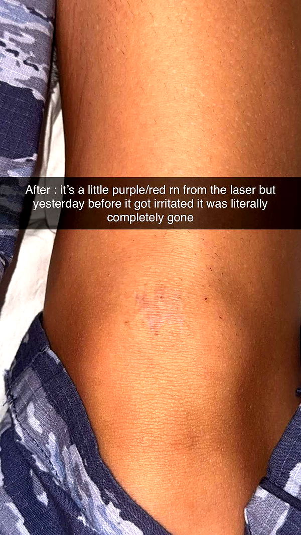 skilahblue image ~ Altpins