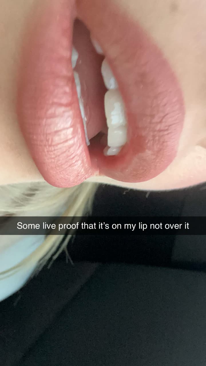 surfsterre snapchat image archive image