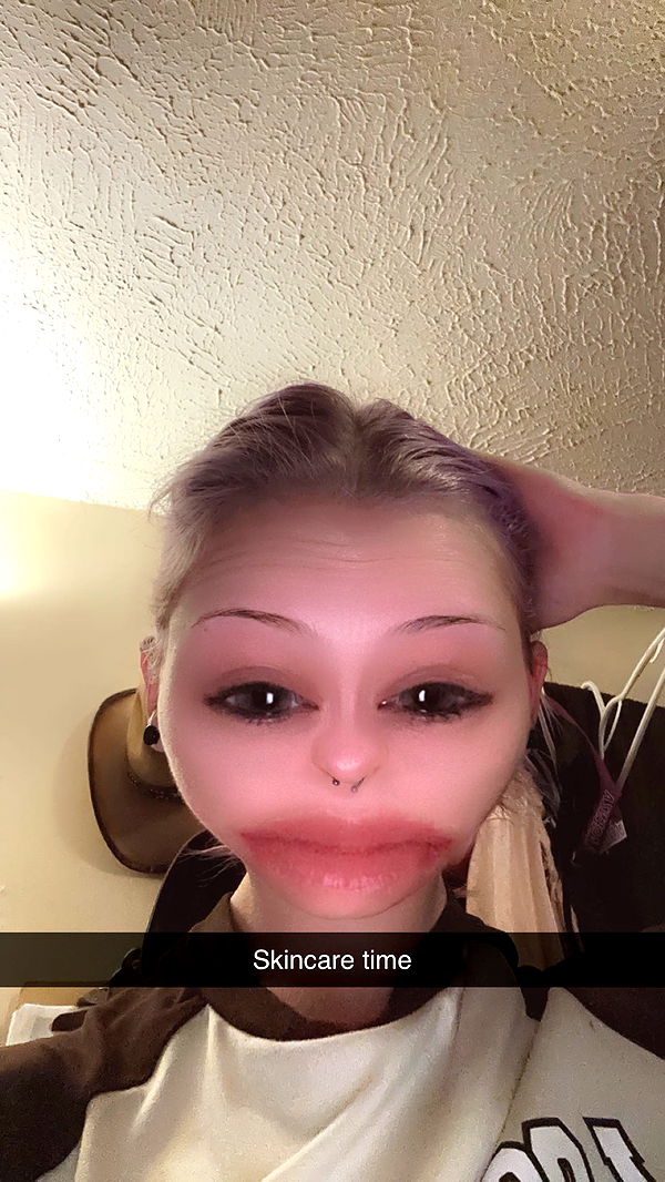 trappkittykhaos image ~ Altpins