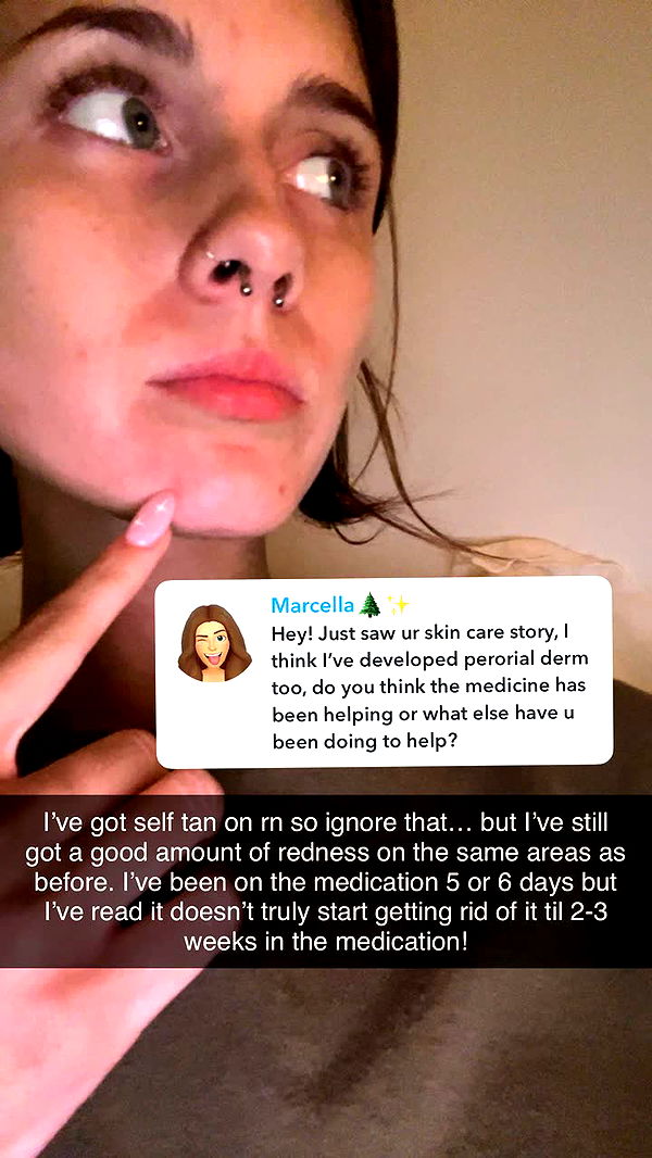 willow.jc image ~ Altpins