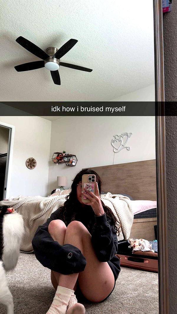 xcatlyn image ~ Altpins