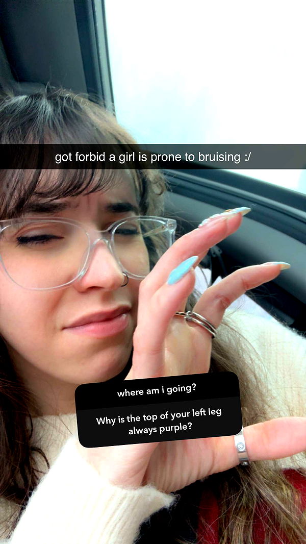 xcatlyn image ~ Altpins