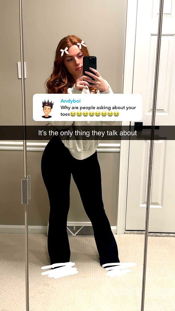 xxxtinacarmella image ~ Altpins