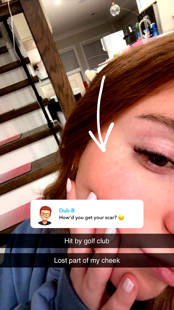 xxxtinacarmella snapchat image archive image