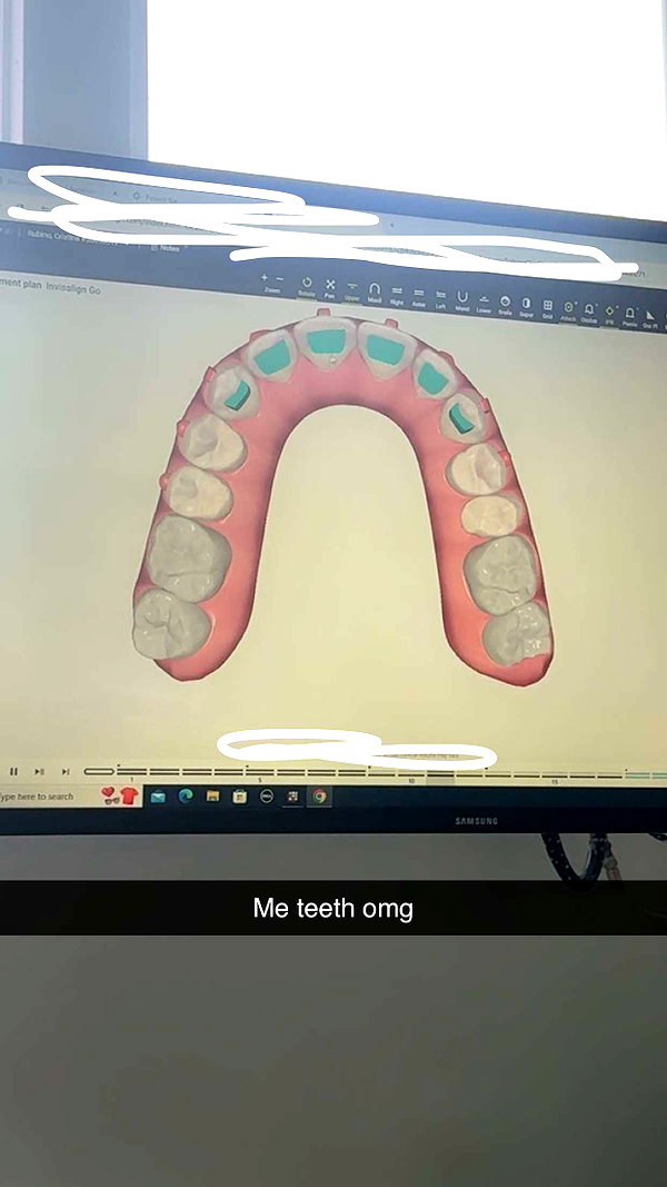xxxtinacarmella snapchat image archive image