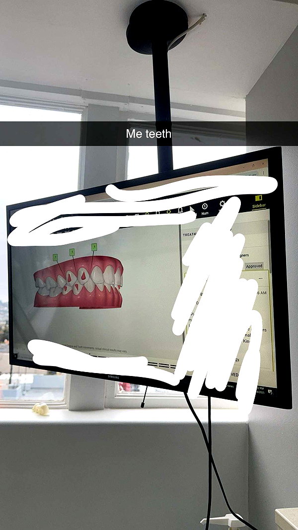 xxxtinacarmella snapchat image archive image