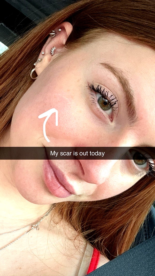 xxxtinacarmella snapchat image archive image