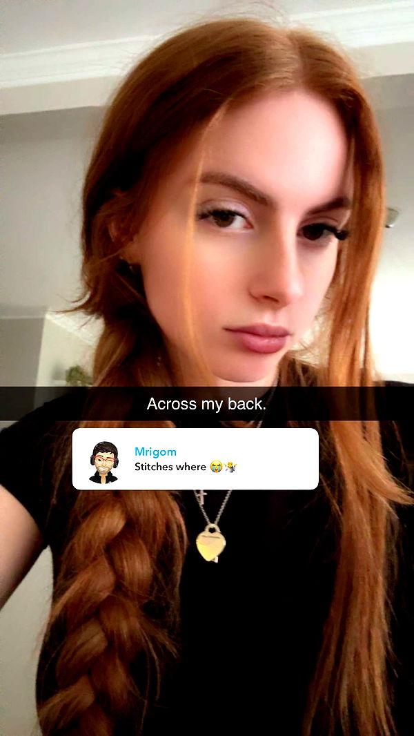 xxxtinacarmella image ~ Altpins