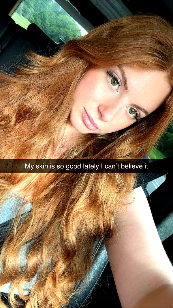 xxxtinacarmella image ~ Altpins