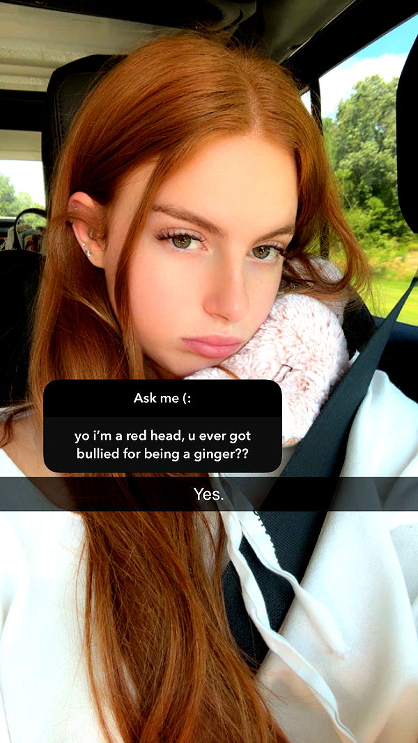 xxxtinacarmella image ~ Altpins