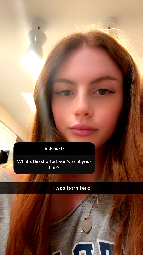 xxxtinacarmella image ~ Altpins