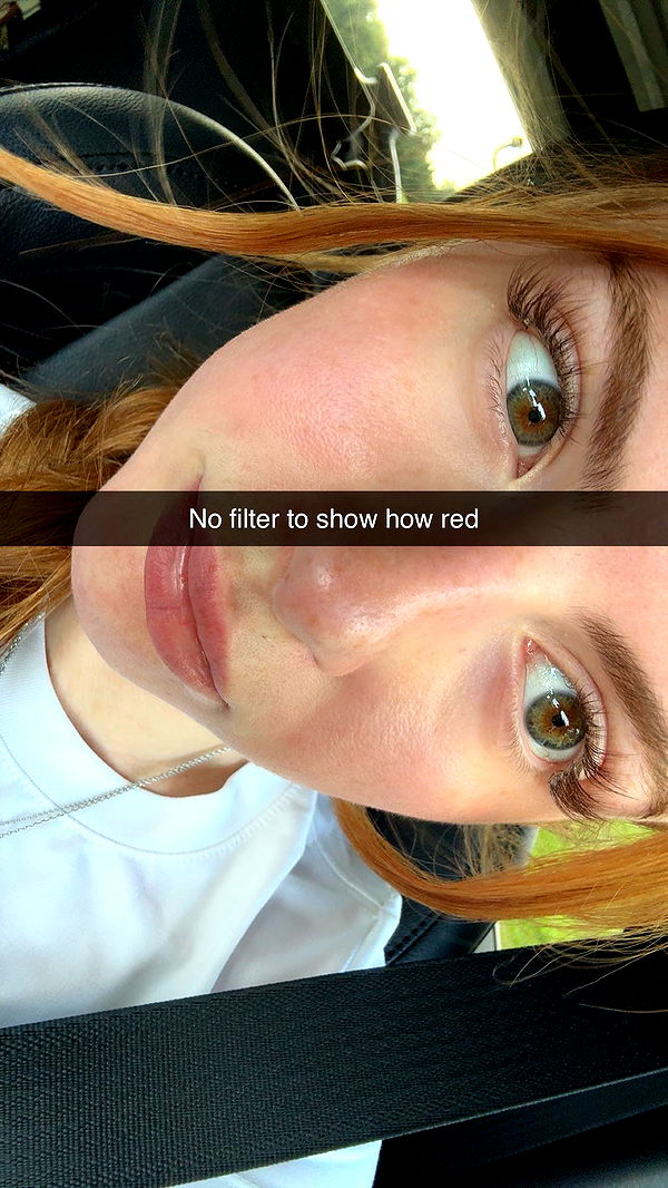 xxxtinacarmella image ~ Altpins