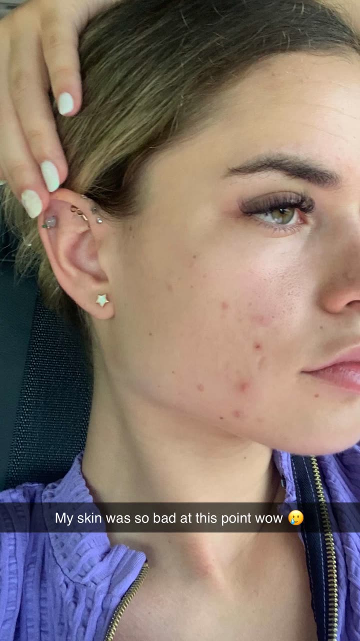 yaslenxoxo snapchat image archive image