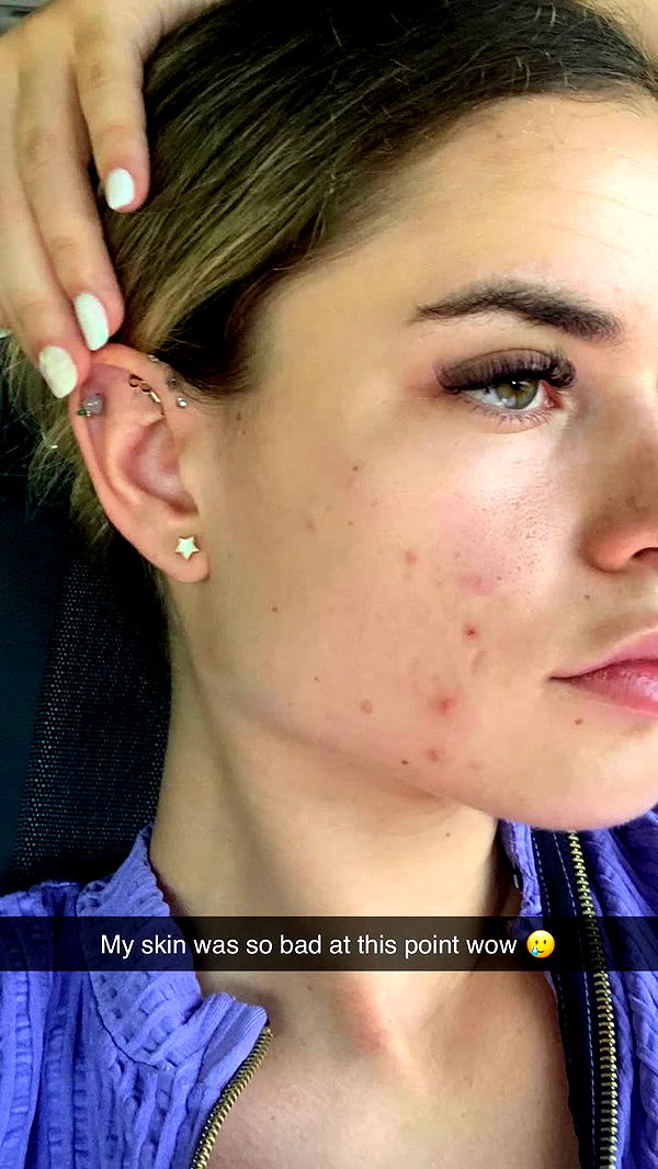 yaslenxoxo image ~ Altpins