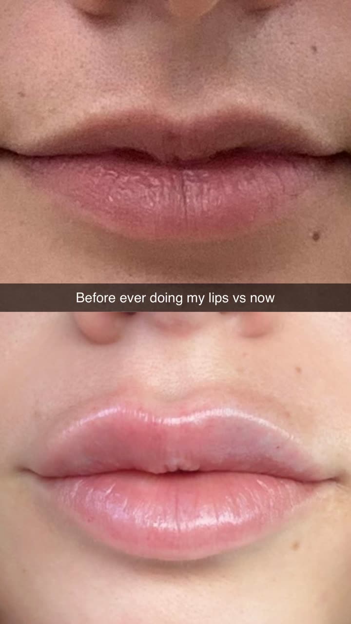 yaslenxoxo snapchat image archive image