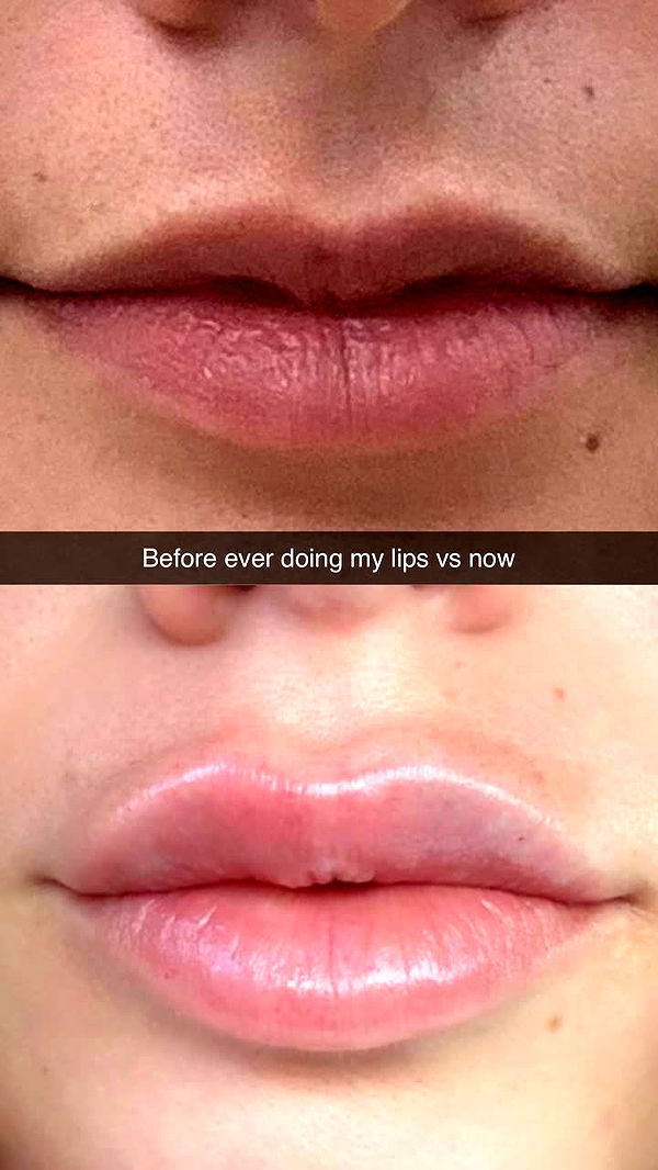 yaslenxoxo image ~ Altpins