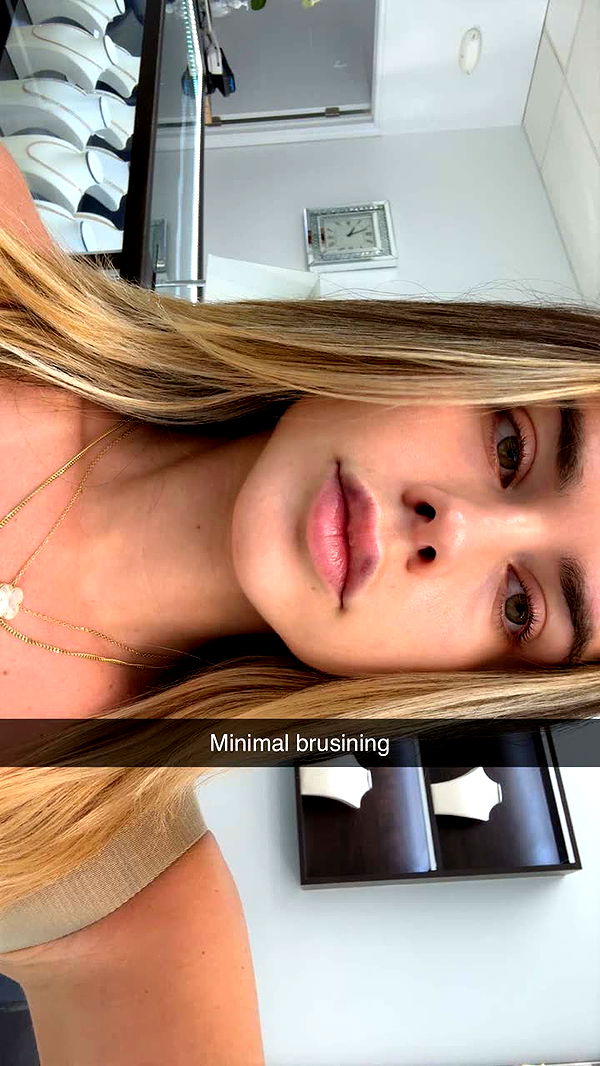 yaslenxoxo image ~ Altpins