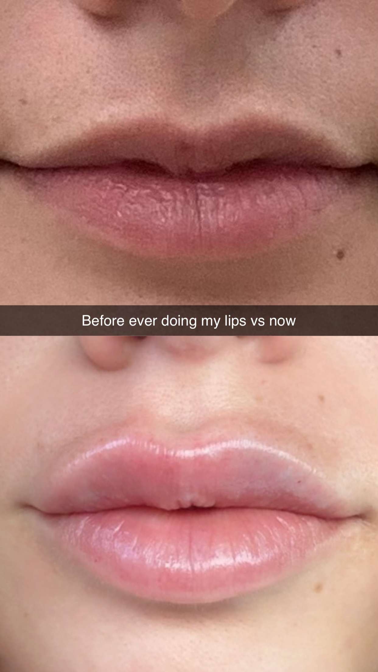 yaslenxoxo snapchat image archive image