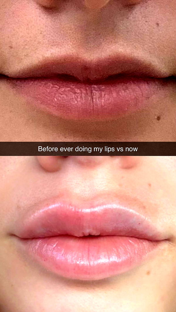 yaslenxoxo image ~ Altpins