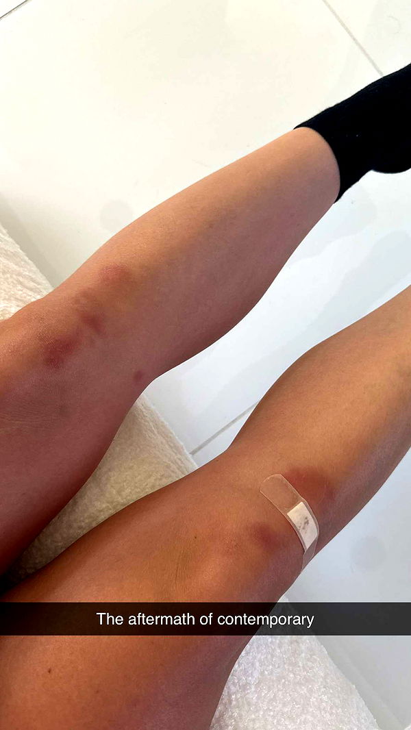 yaslenxoxo image ~ Altpins