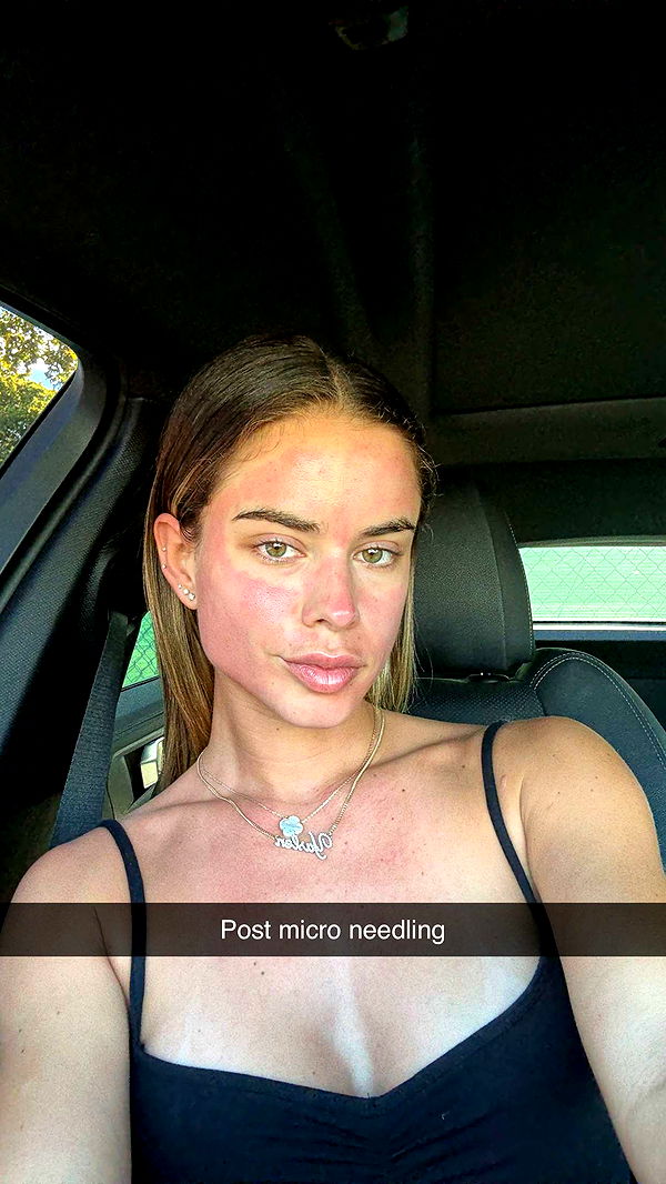 yaslenxoxo image ~ Altpins