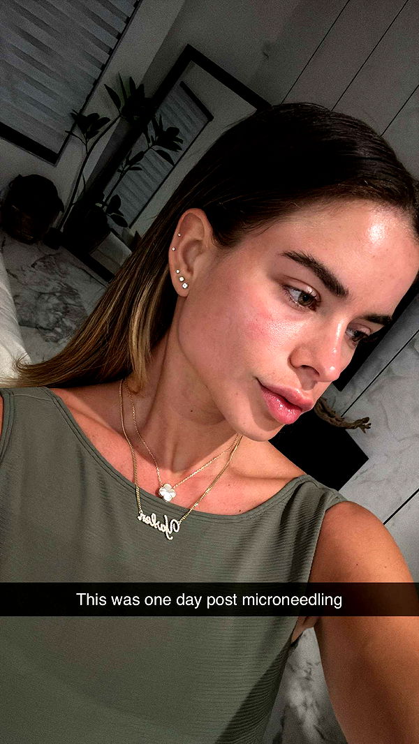 yaslenxoxo image ~ Altpins