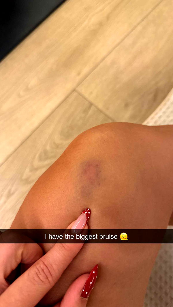 yaslenxoxo image ~ Altpins